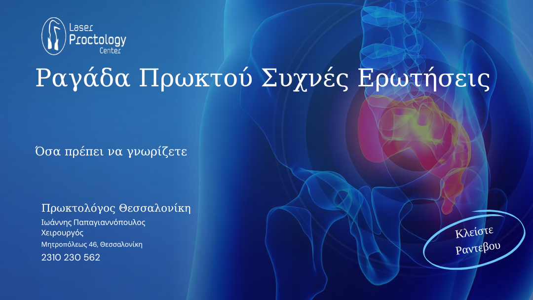 Ραγάδα Πρωκτού Συχνές Ερωτήσεις